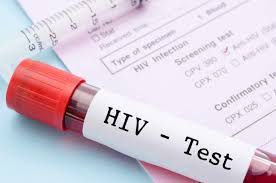 Впечатляющие результаты исследований в области ВИЧ!